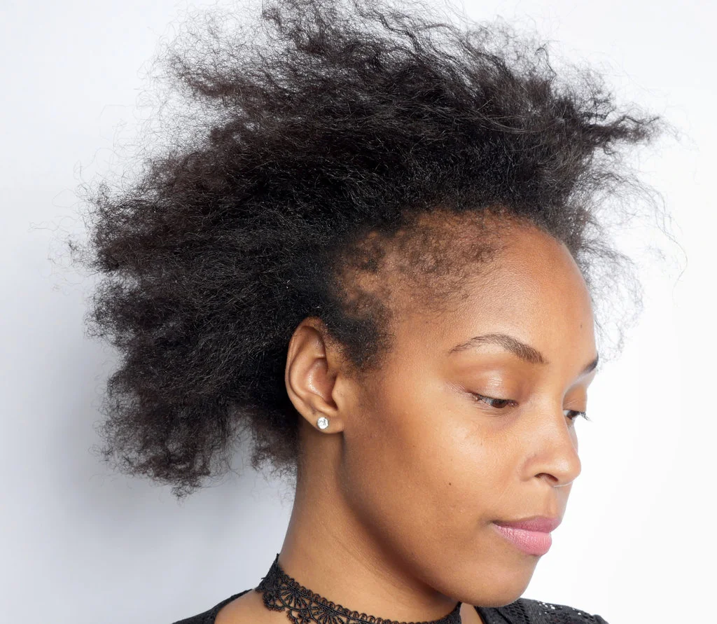 A black woman with thinning hair